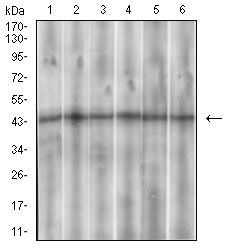 SSTR3