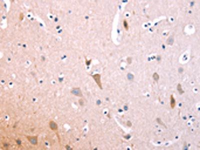 IL1RL1 Antibody