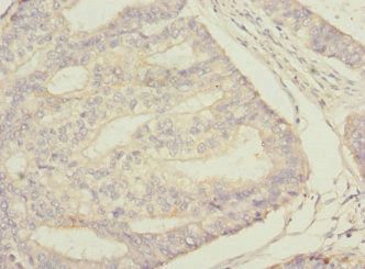 STAM2 Antibody
