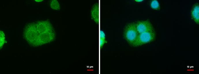 StAR antibody
