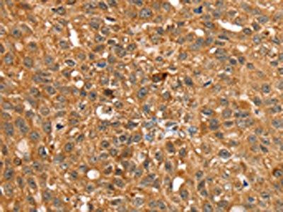 STARD5 Antibody