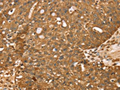 STARD5 Antibody