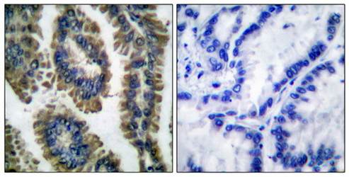 STAT2 (Phospho-Tyr690) Antibody