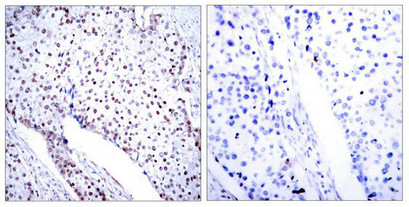 STAT3 (Ab-705) Antibody