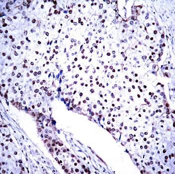 STAT3 (Ab-705) Antibody