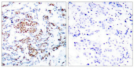STAT5A (Ab-694) Antibody