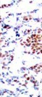 STAT5A (Ab-694) Antibody