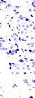 STAT5A (Ab-694) Antibody