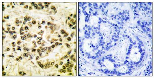 STAT5B (Phospho-Ser731) Antibody