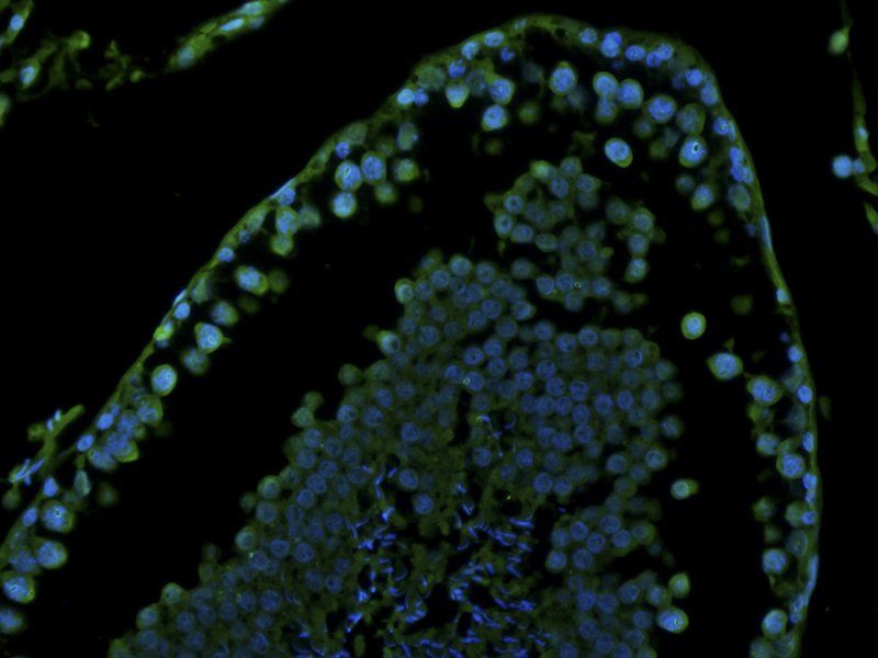 Stathmin antibody (FITC)