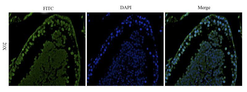Stathmin antibody (FITC)