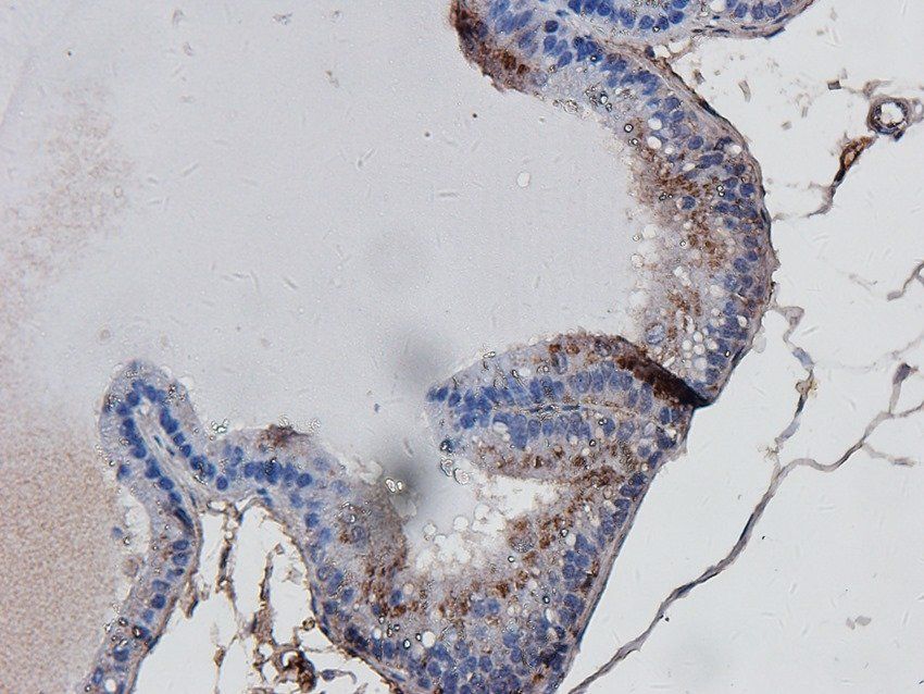 STEAP1 antibody