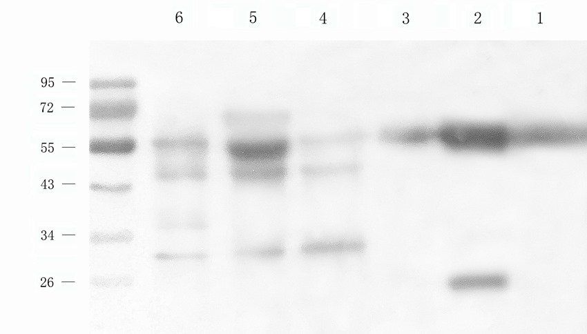 STEAP1 antibody