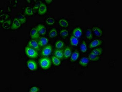 CYP17A1 Antibody