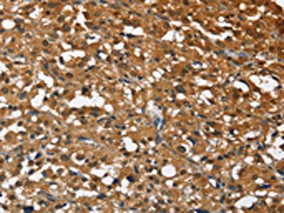 STK17B Antibody
