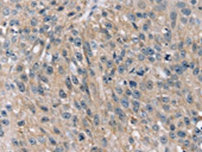 STK33 Antibody