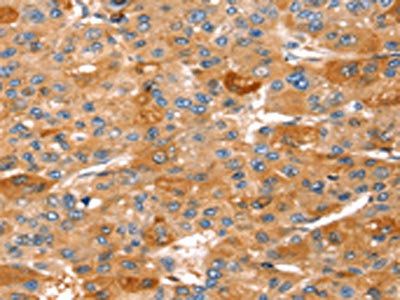 STK33 Antibody