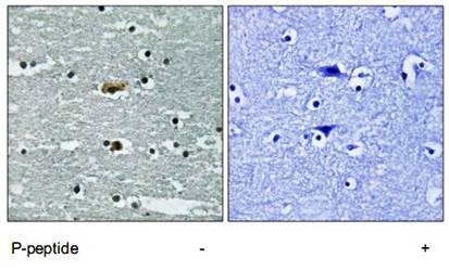 STK39 (Phospho-Ser311) Antibody
