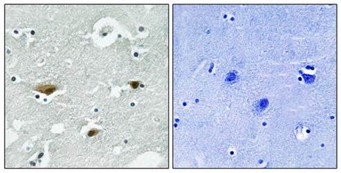 STK39 (Phospho-Ser325) Antibody