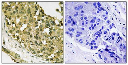 STMN1 (Phospho-Ser62) Antibody