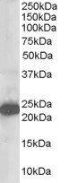 STMN2/SCG10 Antibody