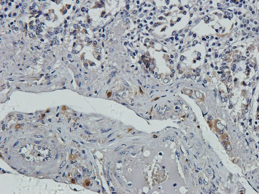Substance P antibody