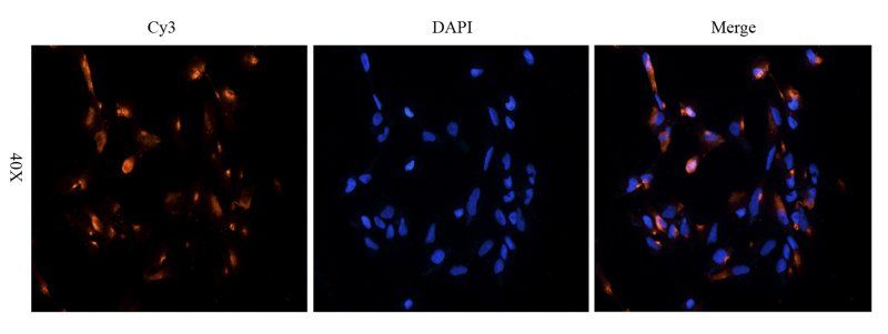 Substance P antibody
