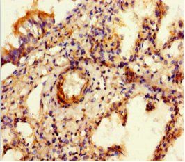 SULF1 Antibody