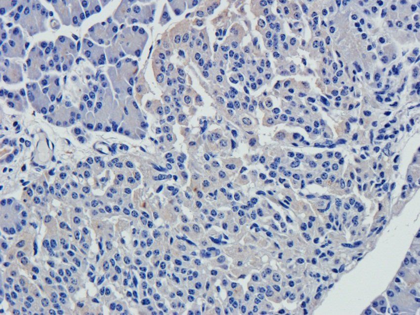 SULF1 antibody