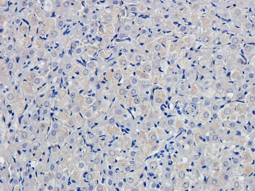 SULF1 antibody