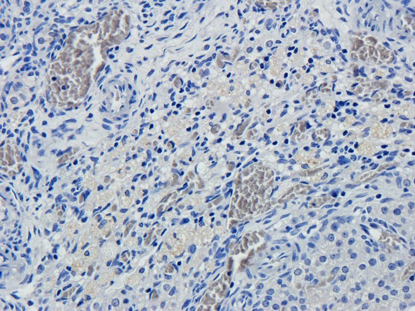 SULF1 antibody