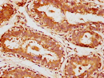SULT1A3 Antibody