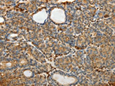 SULT1E1 Antibody