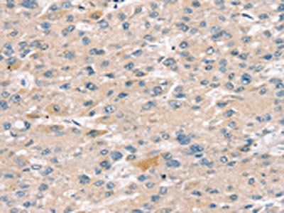 SULT2B1 Antibody