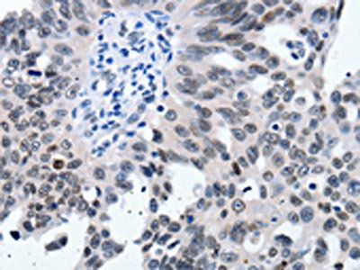 SUMO1 Antibody