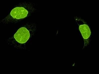 SUN2 Antibody - 0.1ml