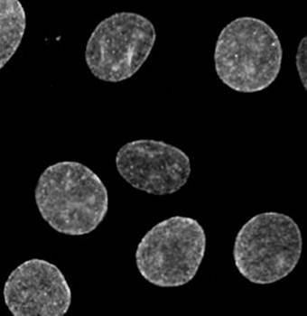 SUN2 Antibody - 50ul