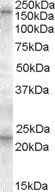 SUR1/ABCC8 Antibody