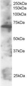 SWAP70 Antibody