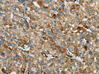 SYCP3 Antibody