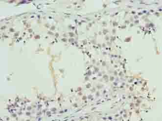 SYNJ2BP Antibody