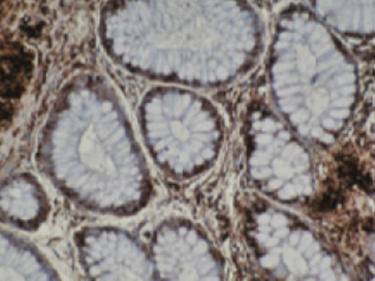 Mouse anti Human T-Complex Protein 1, subunit