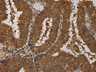 TAB1 Antibody