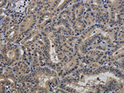 TAB1 Antibody