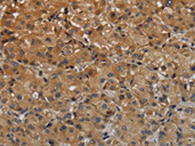 TAB1 Antibody