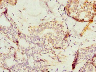 TAF12 Antibody