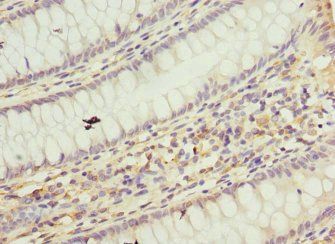 TAF12 Antibody