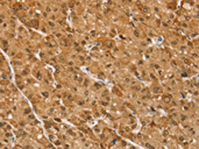 TAF12 Antibody