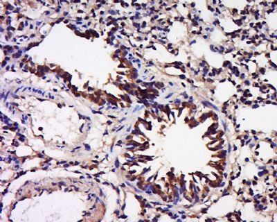 TAF12 Rabbit Polyclonal Antibody