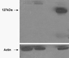 TANK2 Antibody